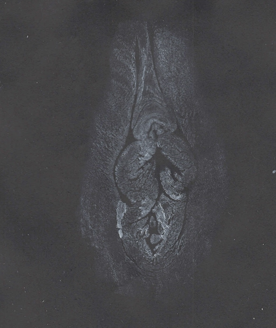 white print of vulva black paper